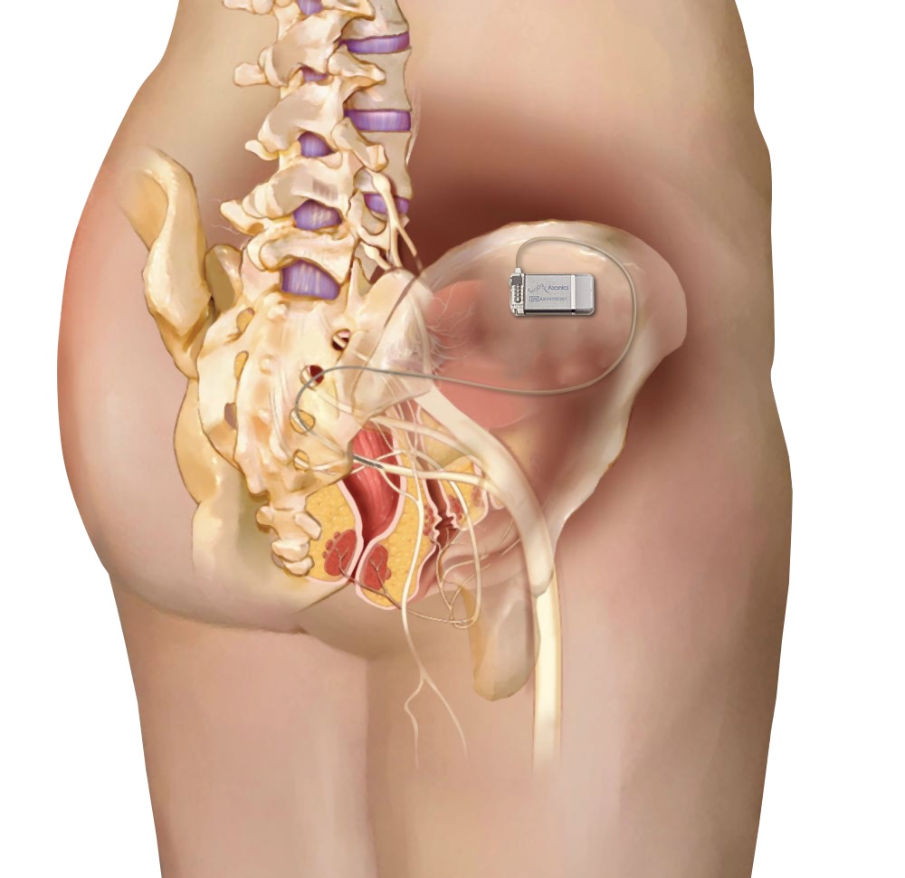 implant-anatomy.jpg