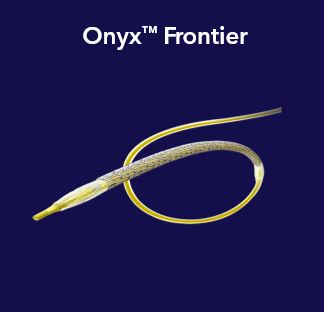 OnyxFrontier.jpg