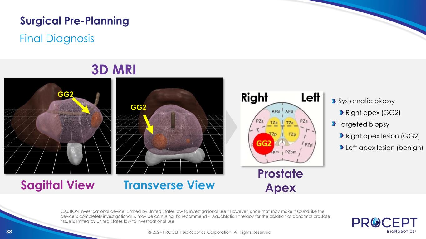 slide38