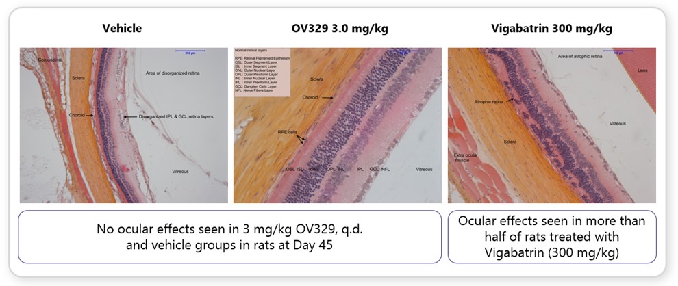 OV329 Comparison Image.jpg