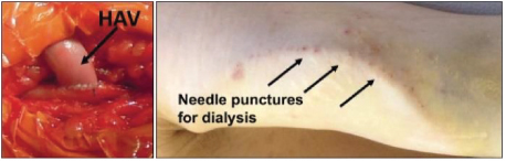 [MISSING IMAGE: tm2127058d1-ph_implant4clr.jpg]