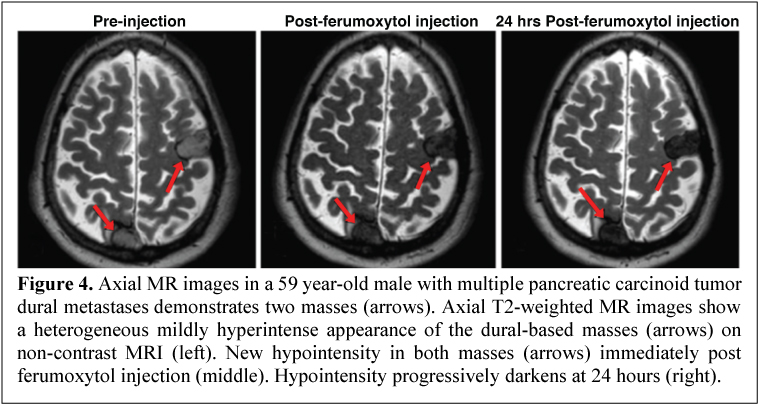 [MISSING IMAGE: tm2038085d2-ph_axialmr4c.jpg]